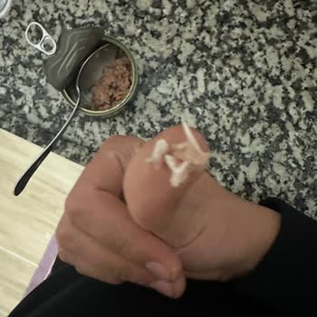 Derya Ton Balığı İçerisinde Çıkan Kılçık Evde Kemik Parçası