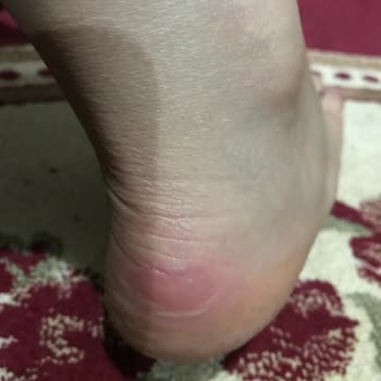 LCW Ayakkabı Ayağımı Vuruyor