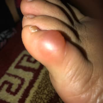 LCW Ayakkabı Ayağımı Vuruyor