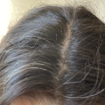 Urban Care Urban Tonik Saç Beyazlatıyor. Toplanıp Dava Açalım