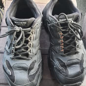 Skechers Sattığı Ürünün Arkasında Durmuyor