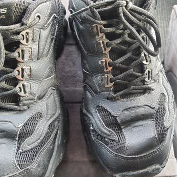 Skechers Sattığı Ürünün Arkasında Durmuyor