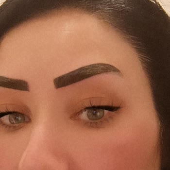 Rukiye Kuba Beauty Studio Kaş Uygulamasında Yaşadığım Mağduriyet Ve Hak Arayışım