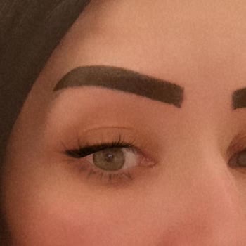 Rukiye Kuba Beauty Studio Kaş Uygulamasında Yaşadığım Mağduriyet Ve Hak Arayışım