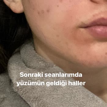 Kadıköy Royal Güzellik Merkezi Güzellik Merkezi Mağduriyeti