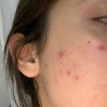 Kadıköy Royal Güzellik Merkezi Güzellik Merkezi Mağduriyeti