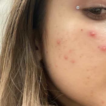 Kadıköy Royal Güzellik Merkezi Güzellik Merkezi Mağduriyeti