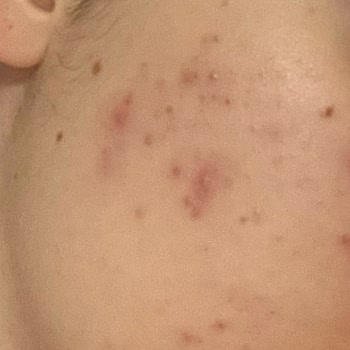 Kadıköy Royal Güzellik Merkezi Güzellik Merkezi Mağduriyeti