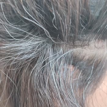 Urban Care Tonik Saçları Beyazlatıyor