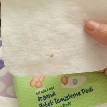 Jenny&willy Pamukları Kirliliği