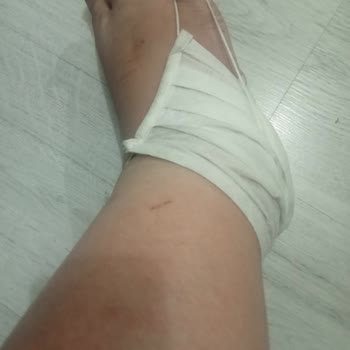 Casinom Paramı Vermiyor Şikayet Deyince Engelledi