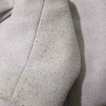 Koton Tüylenme Yapıyor Ama Mağaza Kabul Etmedi