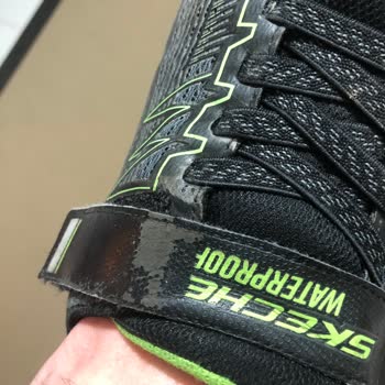 Skechers 403805L Ayakkabıda Soyulma Oldu!