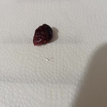 Migros Çiğ Kuruyemiş İçinden Çıkan Parçalar