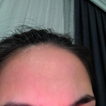 The Purest Solutions The Purest Tonik Ve Kırmızı Peeling