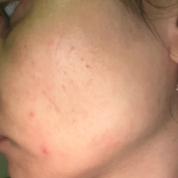 Neutrogena Pembe Greyfurt Ve Gratis Çalışanları