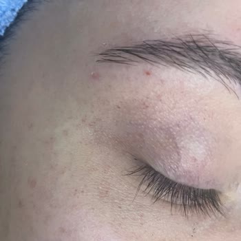 Flormar Stay Perfect Concealer İlk Kullanımda Göz Çevremi Mahvetti!