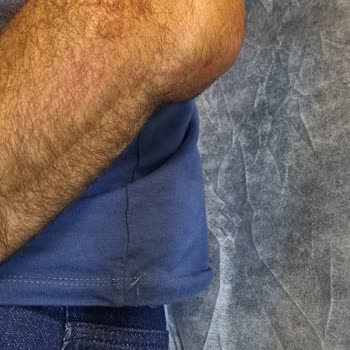 Yasomi Scooter Direksiyon Mandalı Açılıyor
