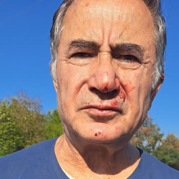 Yasomi Scooter Direksiyon Mandalı Açılıyor