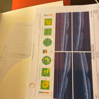 Dünya Göz Hastanesi Hastanesinin Gözüme Yanlış Teşhis Koyması.