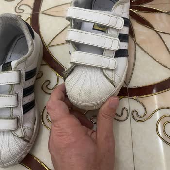Adidas Ayakkabının Deformasyonu Ve Adidas'ın İlgisizliği