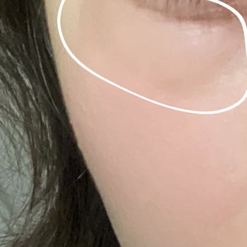 Loreal Paris Göz Serumu Alerji?