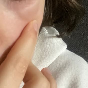 Loreal Paris Göz Serumu Alerji?