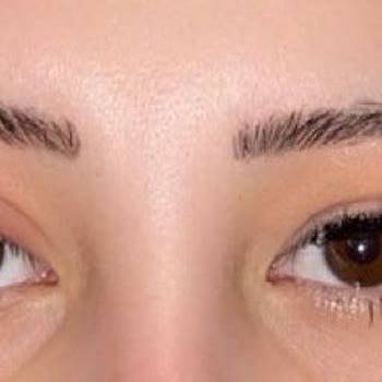 Kayseri Selin Beauty Center Gözüm Enfeksiyon Kaptı Fazla Para Çekildi