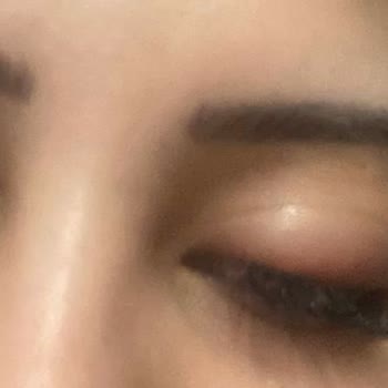 Kayseri Selin Beauty Center Gözüm Enfeksiyon Kaptı Fazla Para Çekildi