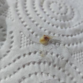 Ruffles İçerisinden Saça Benzer Bir Şey Çıktı