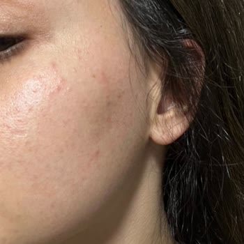 Bepanthol Derma Vücut Kremi Alerji