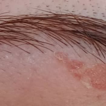 Vi-Vet Tüy Sarartıcı Krem Kaşımı Yaktı!