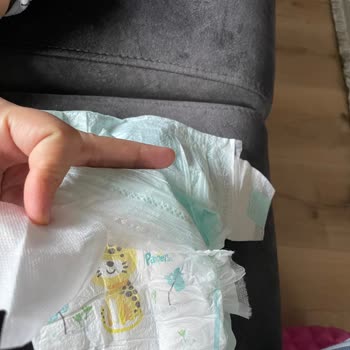 Prima Sızdırma Sorunu Ve Cırtların Kopması.