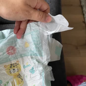 Prima Sızdırma Sorunu Ve Cırtların Kopması.