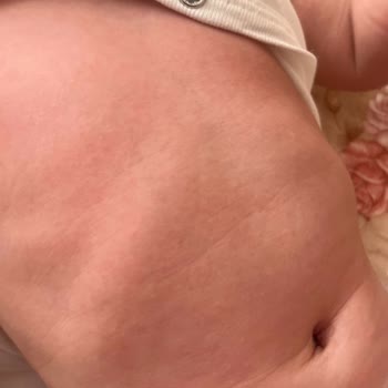Mustela Doğal Olduğundan Şüphe Duyuyorum Pıtırcıklar Yapıyor
