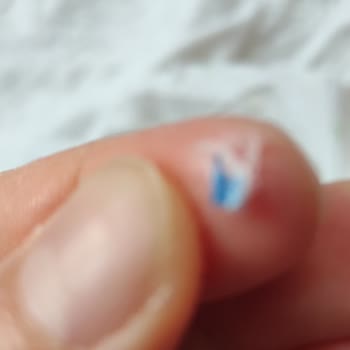 Baby Turco Bebek Bezinin İçinden Plastik Çıktı