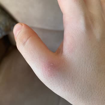 Dyson Süpürge Elimde İz Bırakıyor