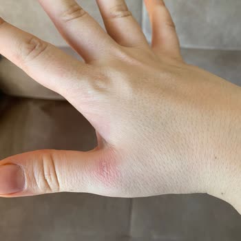 Dyson Süpürge Elimde İz Bırakıyor