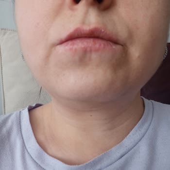 Remos Güzellik Merkezi (İncirli) Remos İnsan Sağlığını Tehdit Ediyor