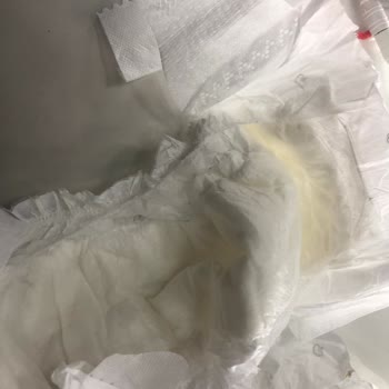 Sleepy Marka Bebek Bezi Yapışkanları Bezi Tutmuyor