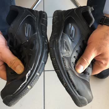 Skechers Ayakkabı İkisi De Hem İç Hem Dış Aynı Yerden Patladı
