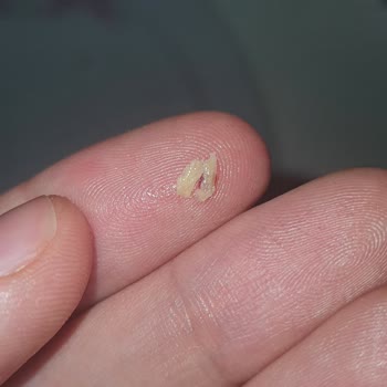 Dardanel Ton Balığında Sert Cisim Çıktı