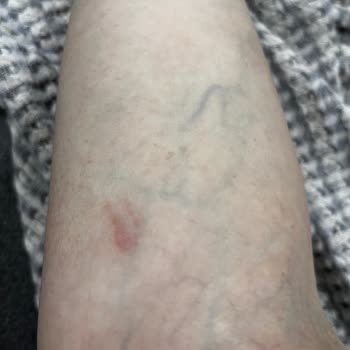 Aprilla Kişisel Bakım Aletleri Aprilla Ürünü İle Yaşanan Tehlikeli Isınma Sorunu