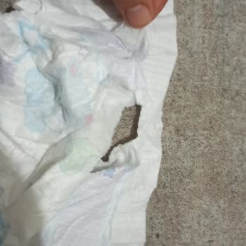 Molfix Bez De Sızdırma Ve Yırtık