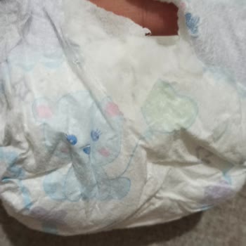 Molfix Bez De Sızdırma Ve Yırtık