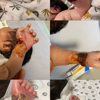Gaziantep Ncr Hastanesi Yenidoğan