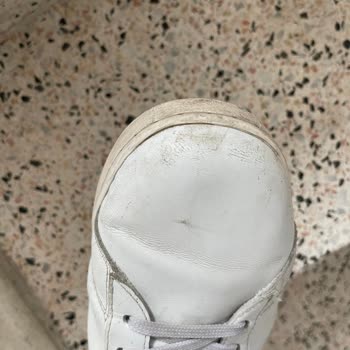 Bir Ayda Parçalanan Lacoste Ayakkabı Hayal Kırıklığı