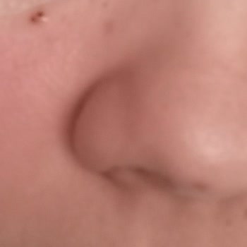 Layansaa Tütsü Kullandım Cildimde Kızarma Ve Yanma Meydana Geldi!