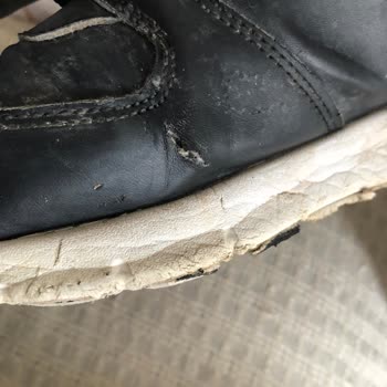 Novada Edremit In Street Ayakkabım Yanlardan Patladı