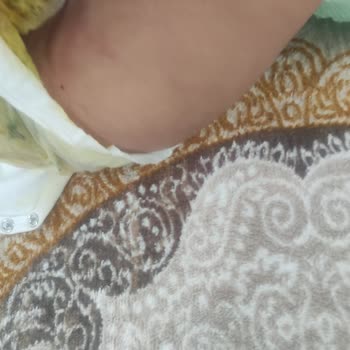 Sleepy Sızdırıyor Alerji Yapıyor Kalitesiz